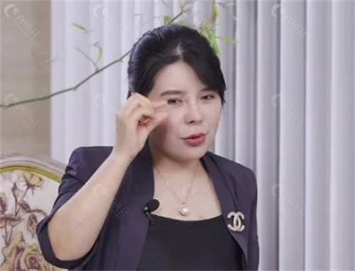 周敏茹双眼皮做的咋样