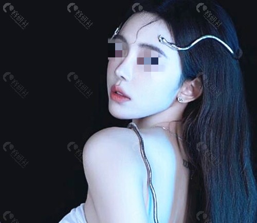 上海黄烈文整形医生做鼻子价格表 上海黄烈文整形医生做鼻子价格表