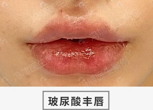 杭州冯啸医生打嘴巴价格表
