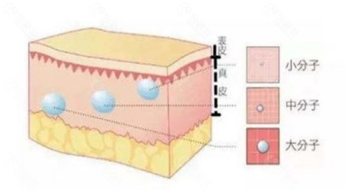 大中小分子玻尿酸的不同注射部位
