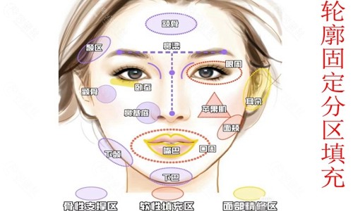西安玻尿酸全脸打造轮廓固定