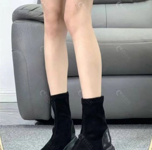 断骨增高手术的危害有哪些？