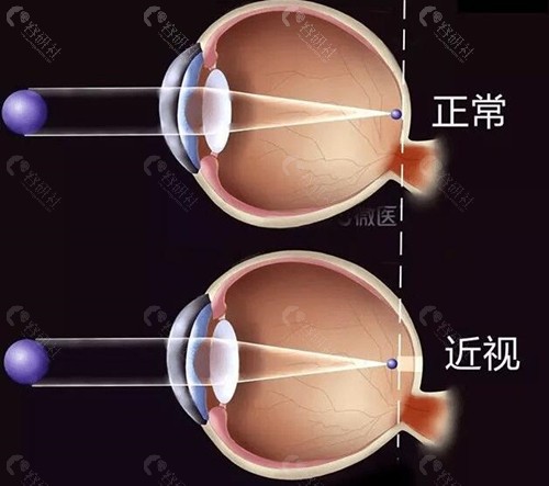 2024武汉中研中医眼科医院收费价格表