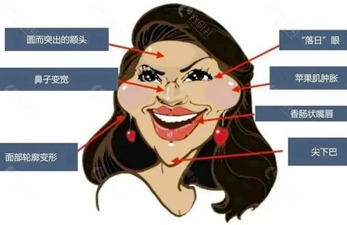 馒化脸怎么消除？杭州馒化脸修复哪家医院做得好？
