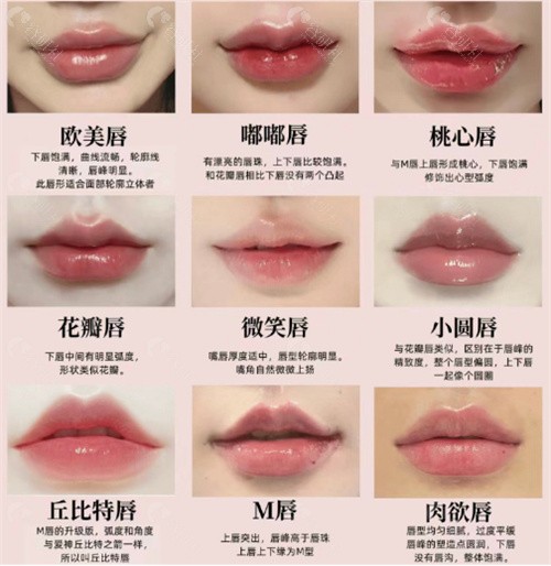 韩国玻尿酸整嘴唇模板+收费价格表公布