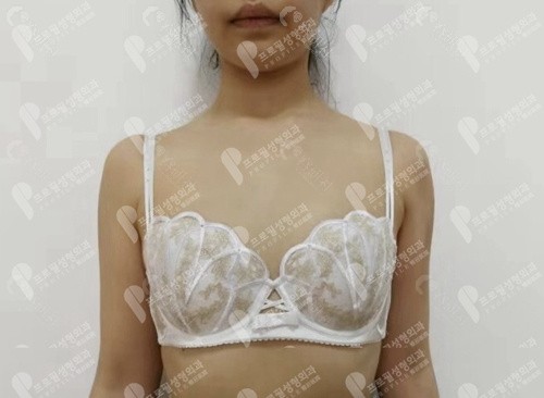 韩国普罗菲耳整形医院蜜桃胸照片