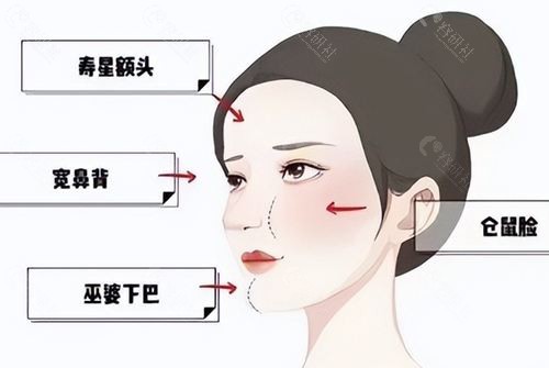 北京王阔远治疗馒化脸怎么样