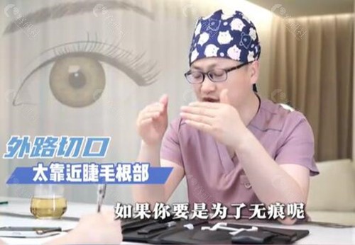上海张楚双眼皮修复收费价格表