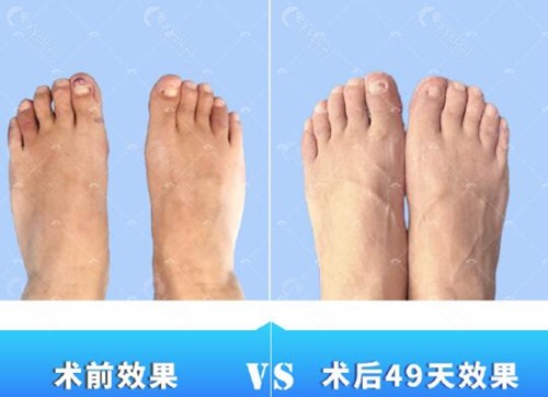 马桂文大脚骨真的好吗？
