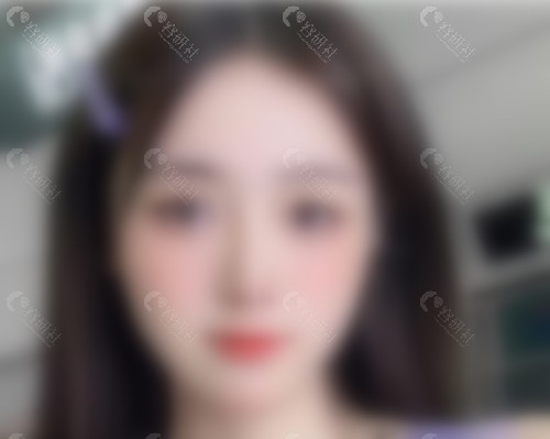 熊宜文做鼻子优势介绍