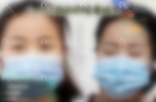 2024北京丰联丽格师丽丽双眼皮修复价格表
