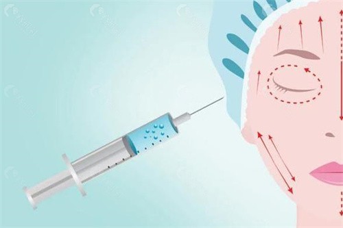韩国医美注射胶原蛋白哪家好？