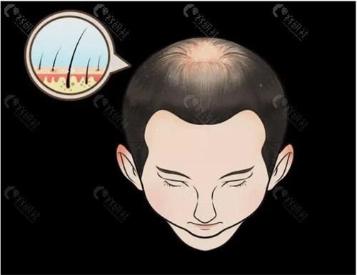 有做过3d纹发的朋友反馈咋样？