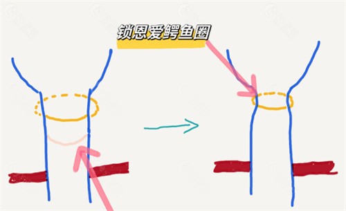 韩国锁恩爱女性私密收费贵吗？