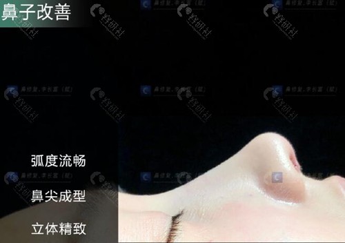 北京李长富做鼻子怎么样？