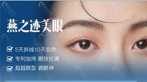 哈尔滨腾双燕医生做双眼皮手术优势介绍