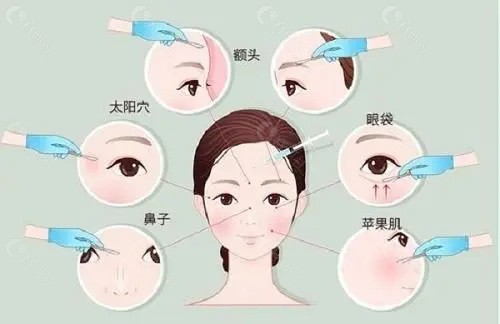 周云超取异物取出怎么样