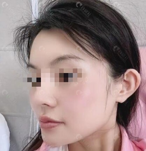 上海磨骨医生杨君毅技术优势