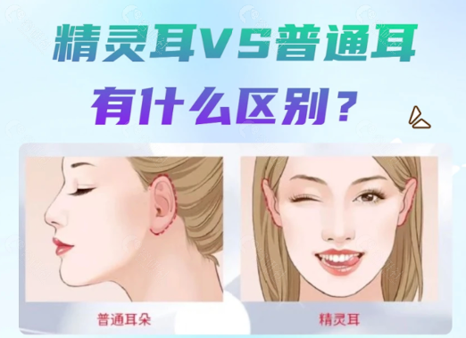 精灵耳注射整形方法大揭秘