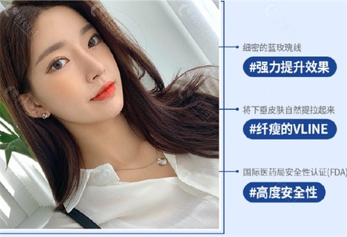 韩国ID医院埋线提升真人实例