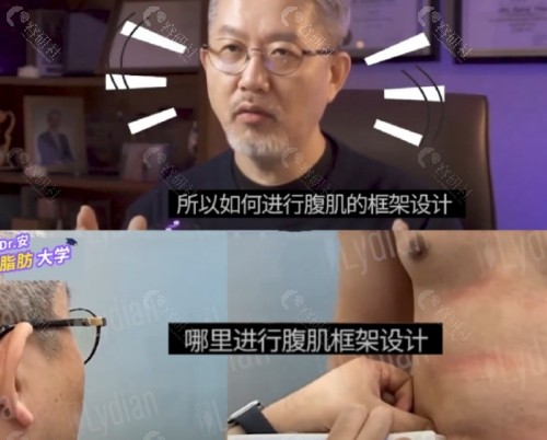 韩国安敬天吸脂审美好