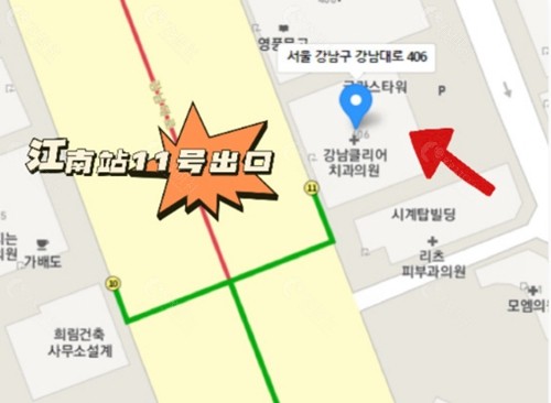 韩国yellow整形做双眼皮怎么样