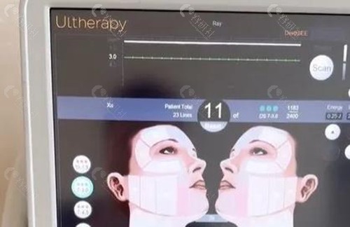 韩国vos皮肤科收费贵吗？