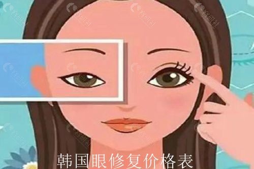 韩国眼修复价格表一览