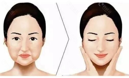 沈阳杏林拉皮手术价格一览表