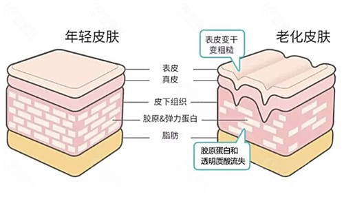 太阳穴凹陷填充方式有哪些