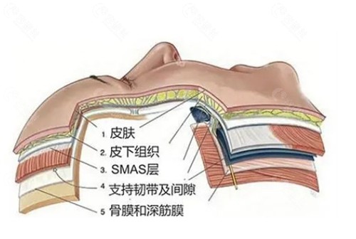 冯立哲PSV面部提升价位