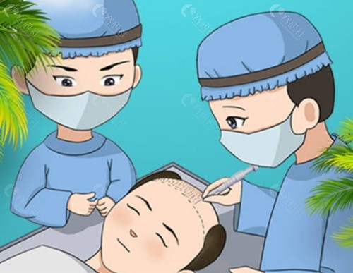 FUE植发有什么优势？