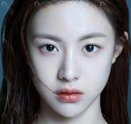 韩国整容模板女孩叫什么名字？