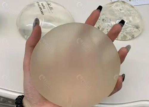 假体隆胸价格