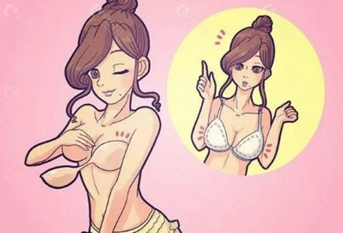 韩国Melon蜜瓜胸部整形价格表