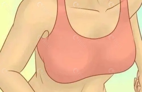 昆明梦想整形医院隆胸口碑