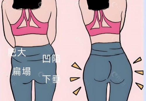 2024王世虎吸脂价格表