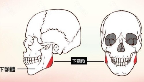 下巴整形多少钱？