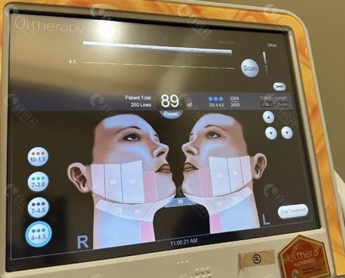 韩国丽菲尔特皮肤科价格表
