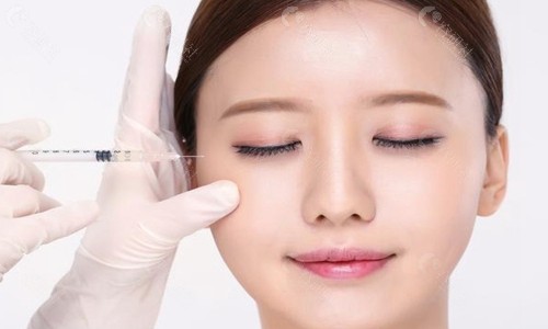 玻尿酸注射去皱图片