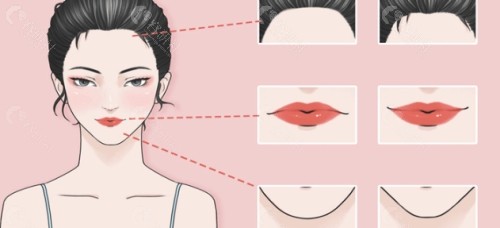 合肥艺星耿继龙丰唇手术预约挂号