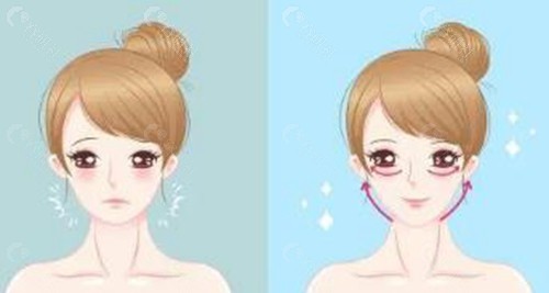 北京四季青橙面部提升哪位医生技术好？