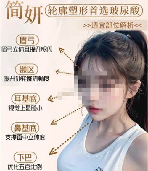 简妍玻尿酸适合部位