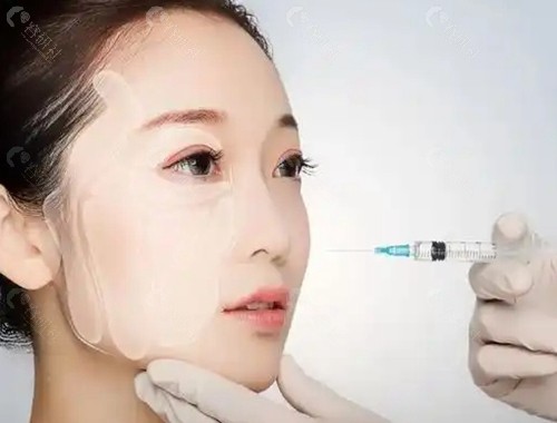 国内打玻尿酸好的医生有哪些