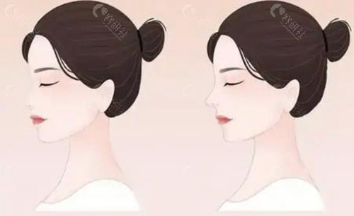 西安鼻子整形医生排名前十