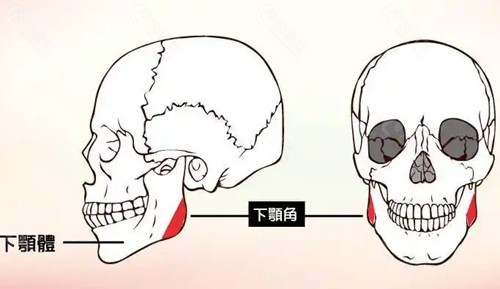 太原磨骨手术流程