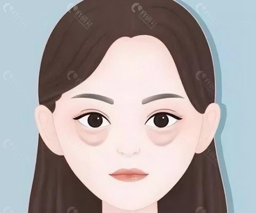 2025广州祛眼袋手术价格一览表