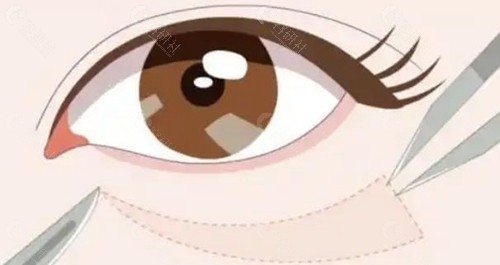广州韩妃整形