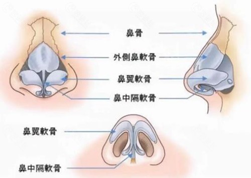 朝天鼻矫正需要多少钱？