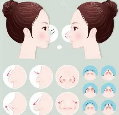 张国强